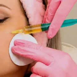 PRP (Plasma Rico en Plaquetas)