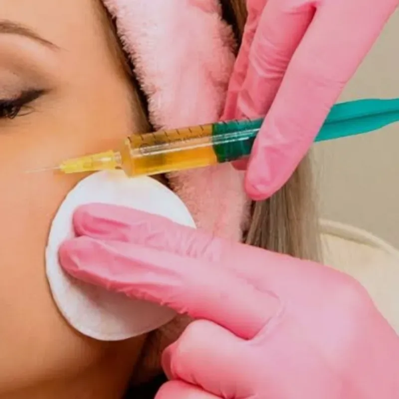 PRP (Plasma Rico en Plaquetas)