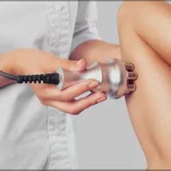 Radiofrecuencia en brazos