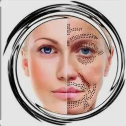 Fibroblast o Plasmapen