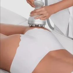 Radiofrecuencia en glúteos