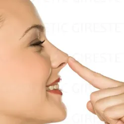 Levantamiento punta nasal