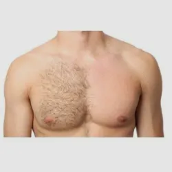 Depilación de pecho