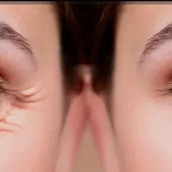 Patas de gallo (24 unidades)