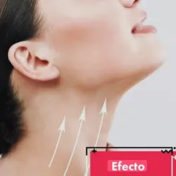 Lifting de cuello o efecto Nefertiti