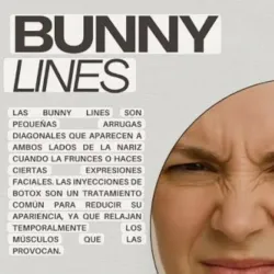 Bunny lines