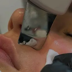 Limpieza Facial Profunda