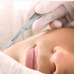 Dermaplaning