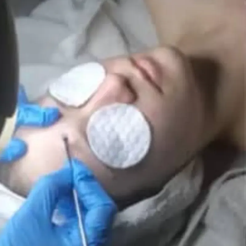 Limpieza facial