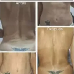 Masaje Post Operatorio ( Cuerpo entero)