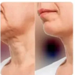 Masaje Post Operatorio por planos 