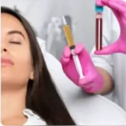 Mesoterapia con plasma rico en plaquetas (PRP)