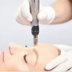 Micropunción con dermapen